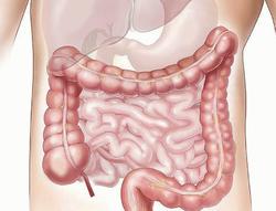 intestinal worm jelentese magyarul